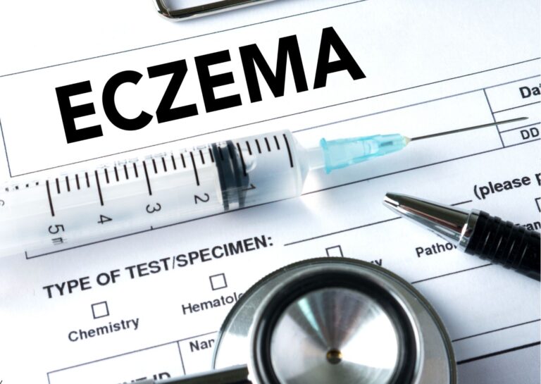 Eczema Treatment for Improved Skin Health